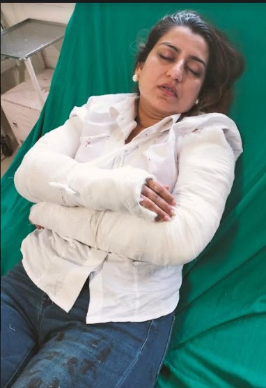 मोहाली में बीती रात जॉब से घर लौटी युवती पर घातक हमला : जान बची, पर दोनों बाजुएं टूटीं  